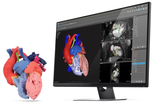 3D-Software zur medizinischen Bildsegmentierung